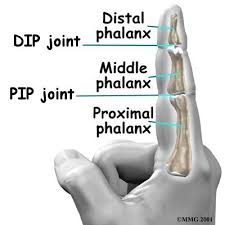 phalangealis arthrosis